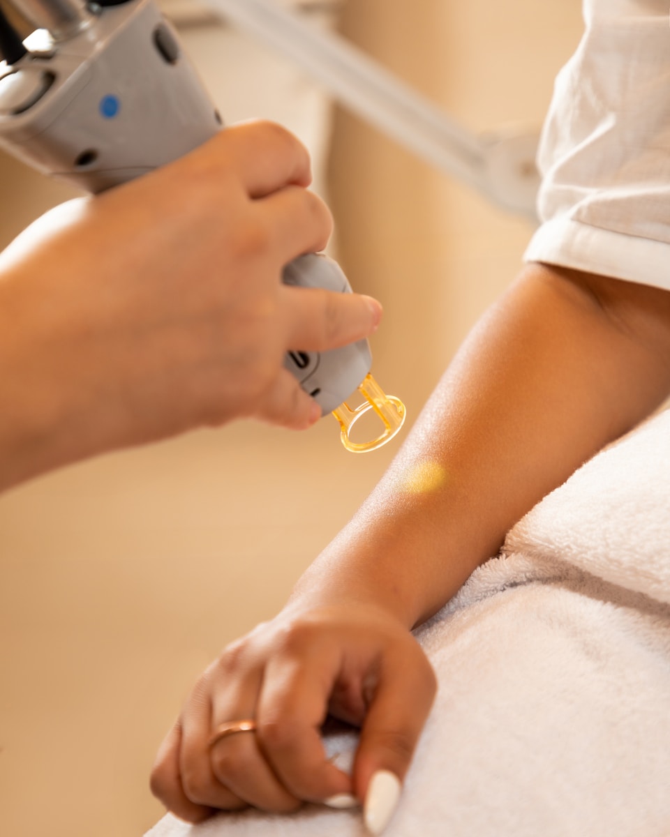 Laserbehandelingen en huidtherapie in Amsterdam